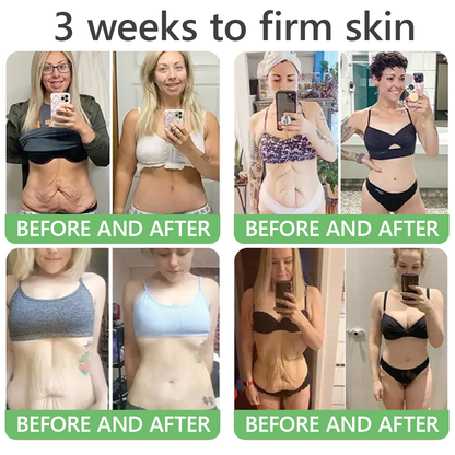 FDA Official: HISKIN® PDRN Multi-Peptide Firming Collagen Body Oil- Anti-aging, Hydrating, Skin Firming & Lifting, Skin Repair, Even Tone, Acne and Dark Spot Treatment, Wart and Mole Removal, and Psoriasis Relief.