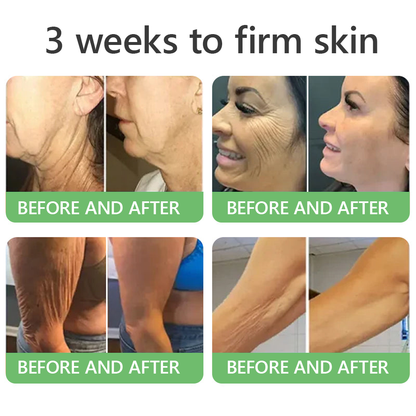 FDA Official: HISKIN® PDRN Multi-Peptide Firming Collagen Body Oil- Anti-aging, Hydrating, Skin Firming & Lifting, Skin Repair, Even Tone, Acne and Dark Spot Treatment, Wart and Mole Removal, and Psoriasis Relief.